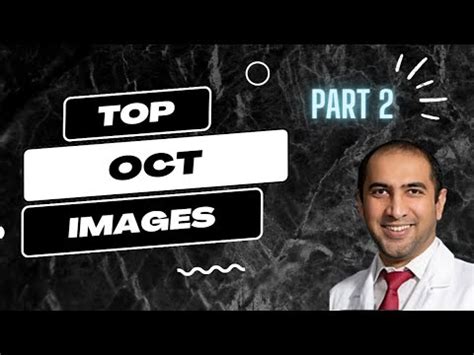 How To Interpret OCT Optical Tomography Coherence Imaging Part II