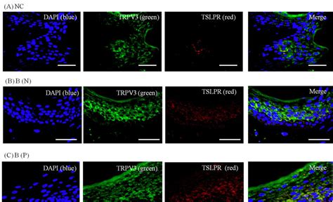 Three Color Immunofluorescence Confocal Images Were Obtained For Dapi