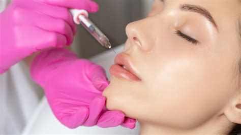 What Is A Lip Flip Procedure?