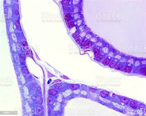 Gambar Golgi Negatif Foto Stok Unduh Gambar Sekarang Aparatus Golgi