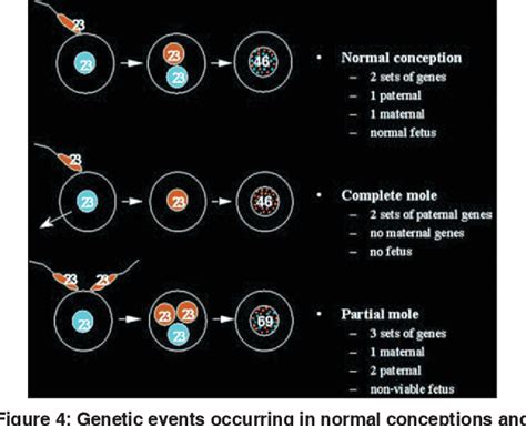 Role Of Ultrasonography In Molar Pregnancy Coexisting With Viable Fetus