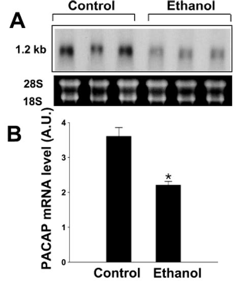 Northern Blot Analysis Of Pacap Mrna In The Rat Testis Of Download Scientific Diagram