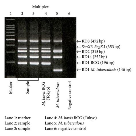 M Bovis Was Identified Using Multiplex Polymerase Chain Reaction