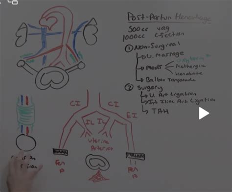 Obgyn Flashcards Quizlet