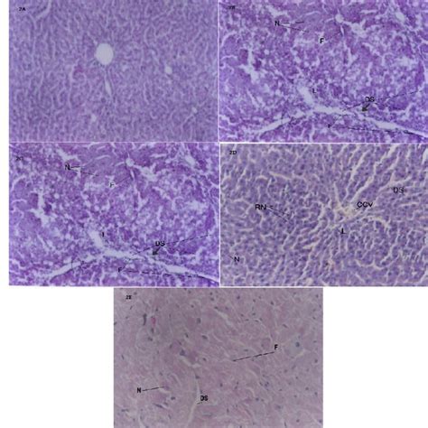 Effect Of M Vulgare And W Somnifera Extracts On Ccl 4 Induced