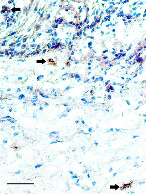 Immunohistochemical Staining Of Ectocervical Tissue Of A Selected Hiv