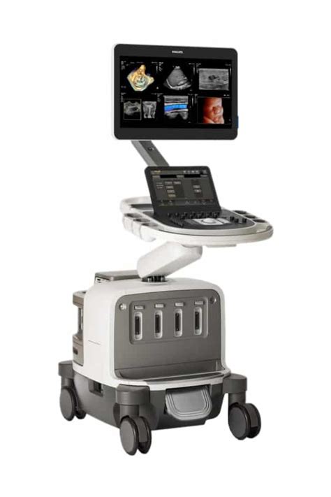 Philips Epiq Ultrasound Systems Overview From Epiq 5 To Elite To Cvxi