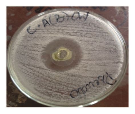 Zone Of Inhibition Of Chloroform Extract Of Bark Of C Ambrosioides L