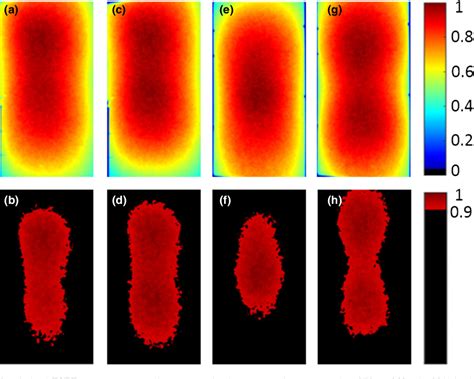 Figure From Improving Treatment Geometries In Total Skin Electron