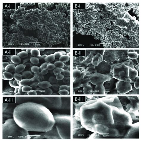 A Scanning Electron Micrographs Showing C Albicans Biofilm After 24