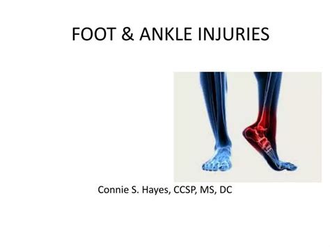 Ppt Foot And Ankle Injuries Powerpoint Presentation Free Download Id