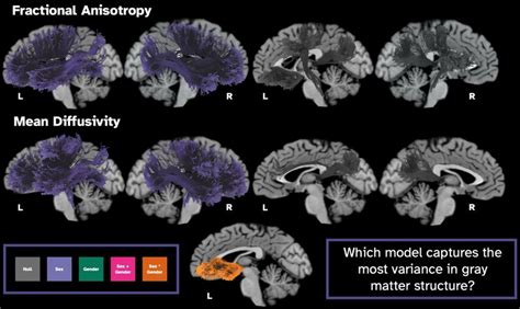 T1 Weighted Images Overlaid With Examined White Matter Tracts Colored