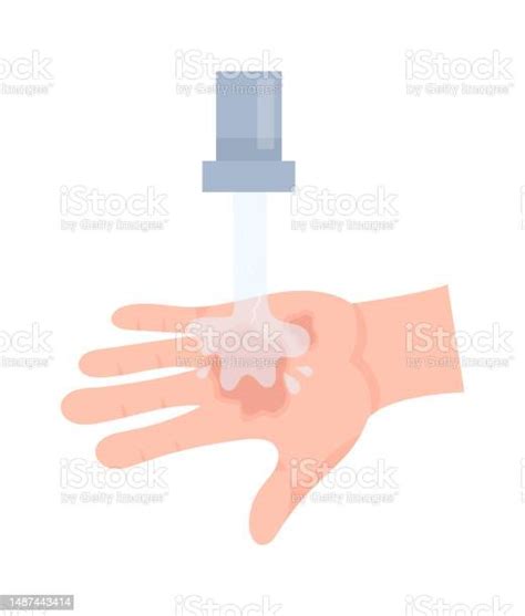 Hand Injuries Treatment With Cold Water Stock Illustration - Download Image Now - Care, Cold And ...