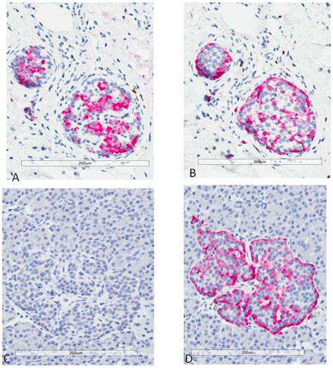 Insulin And Glucagon Immunostaining Immunohistochemical Staining For