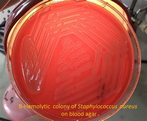 Staphylococcus aureus: Introduction, pathogenecity, lab diagnosis and