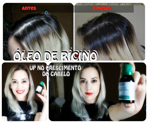 Óleo De Rícino Cabelo Antes E Depois - Antes E Depois Oleo De Ricino
