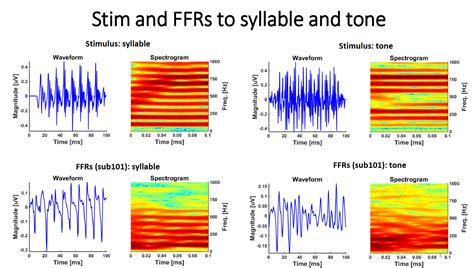 Eeg Ffr Classification In Matlab A Tutorial