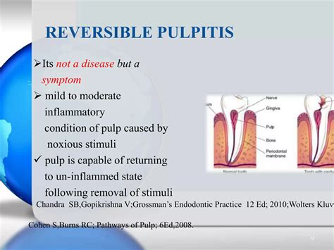 Pulpal & periradicular diseases & their diagnosis | PPTX