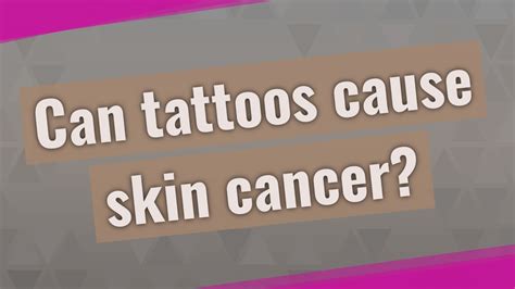 Can Tattoos Cause Skin Cancer Youtube