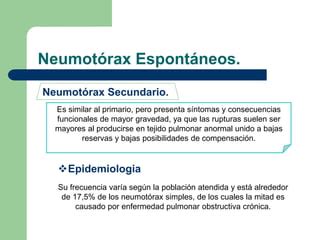 Atelectasia Y Neumotorax Ppt