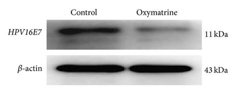 Expressions Of Hpv16e7 Mrna And Protein In Hep 2 Cells Treated With