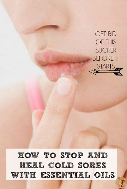 How To Stop And Heal Cold Sores With Essential Oils Ancestral