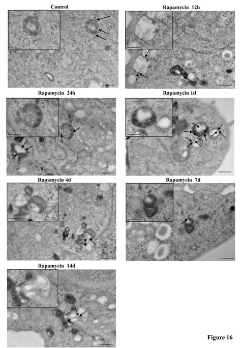 Representative Pictures Of Rapamycin Induced Lc3 Stained And