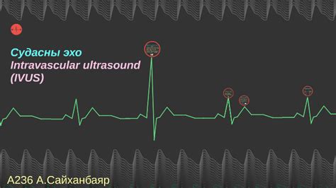Судасны эхо Intravascular ultrasound IVUS by Сайханбаяр Амарбаяр on Prezi