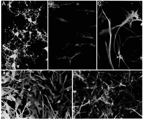 Immunofluorescence labeling of cultures to identify various cell types ...
