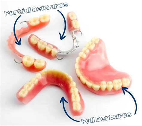 Dentures Vs Veneers The Differences Whats The Better Choice