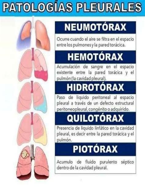 Patologias Pleurales Fraii UDocz