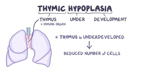 Atrophy, Aplasia, And Hypoplasia: Video Anatomy Osmosis, 52% OFF