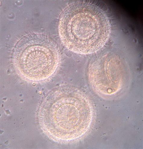 trichodina_CB01.jpg | Fish Pathogens