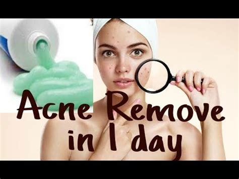 How To Remove Pimples Fast Get Ride Of Pimple And Acne In One Day