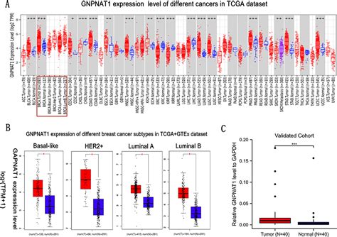 Gnpnat An Unfavorable Breast Cancer Prognosis Marker Bctt