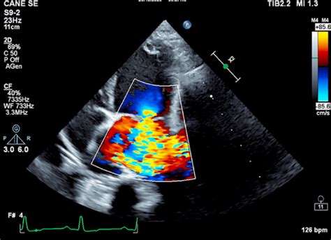 Mitral Valve Endocardiosis In A 10 Years Old Female Cavalier King