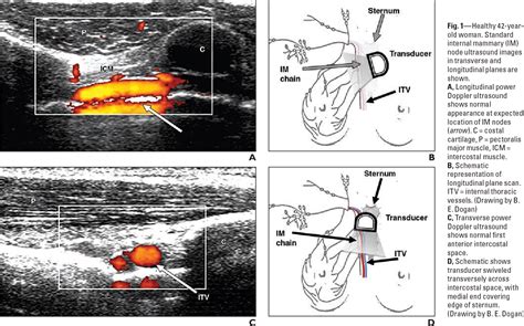 Figure From Sonography And Sonographically Guided Needle Biopsy Of