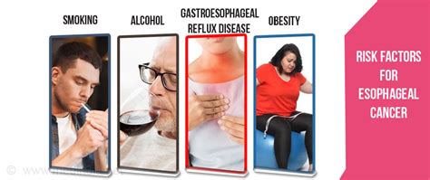 Esophageal Cancer Types Risk Factors Symptoms Diagnosis Treatment Prevention Prognosis