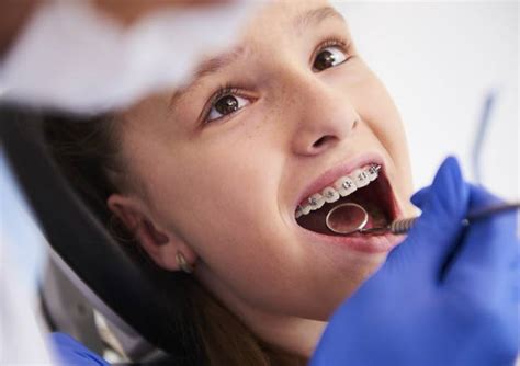 Sleep Apnea And Orthodontics Can Orthodontic Treatment Help