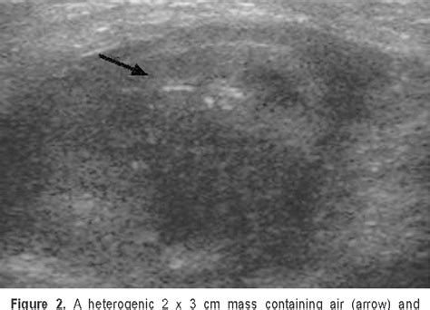 Figure 1 From Critical Validation Of Ultrasound Doppler In The