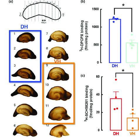 Both A1r And A2ar Have A Greater Density In Dh Than In Vh A Three Download Scientific