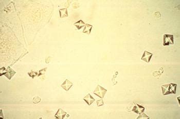 Urinalysis Flashcards Quizlet