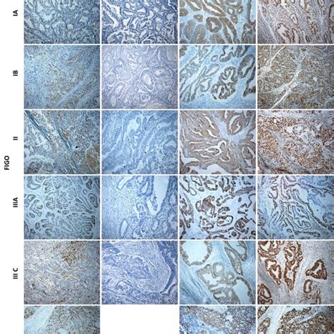 Representative Immunohistochemical Microphotographs Brown Color