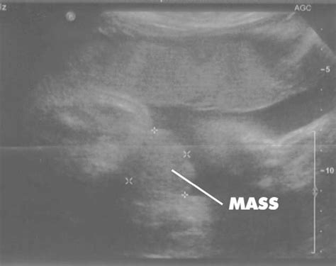 Bladder Exstrophy And Epispadias Complex Pediatric Urology Book