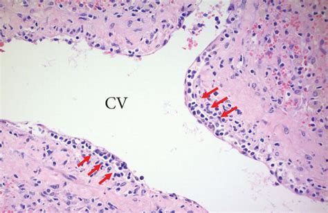 A The Liver Reveals Massive Hepatocyte Necrosis The Lobular Download Scientific Diagram