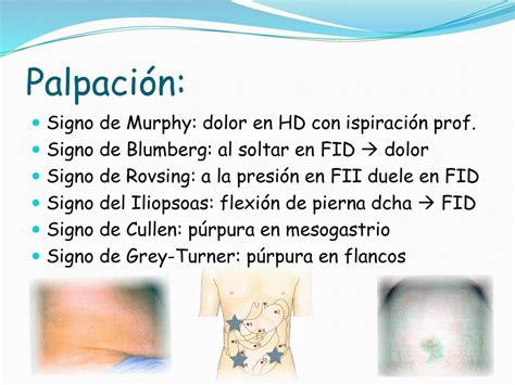 Exploraci N Abdominal Ppt Descargar