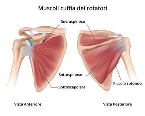 Tendinite Della Spalla