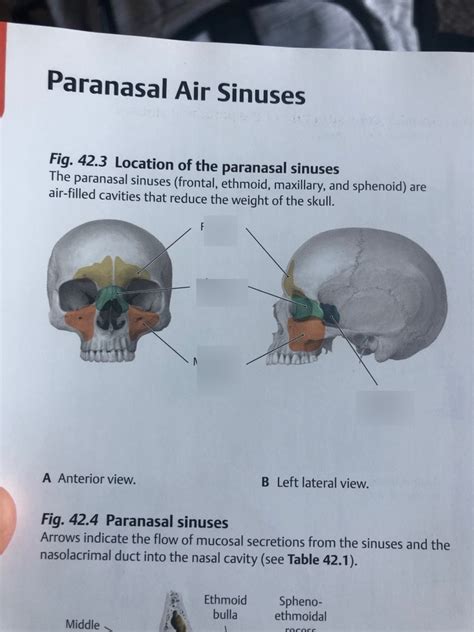 Sinuses Diagram Quizlet