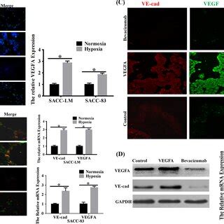 Exogenous Vegfa Promoted Emt And Stemness Of Sacc Cells In Vitro A