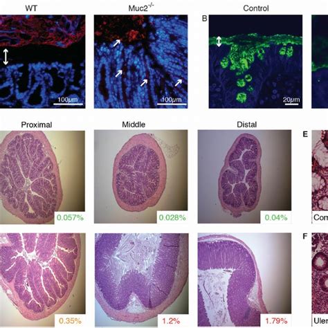 Histology Of Colon Tissue From Muc Mice And Uc Patients A